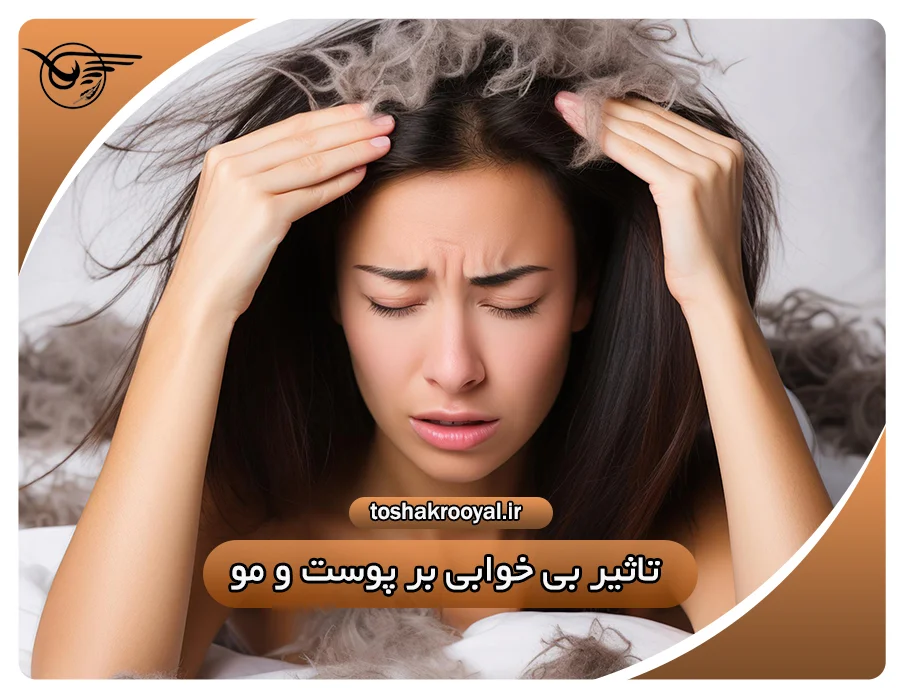 تأثیر بی خوابی بر پوست و مو